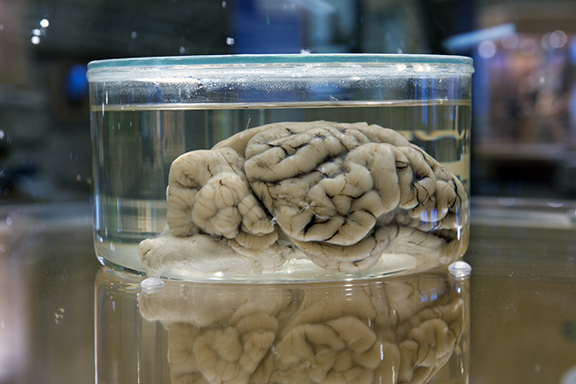 A variety of brains are on display at WonderLab, including those of a deer, shown here. Photo by Kendall Reeves