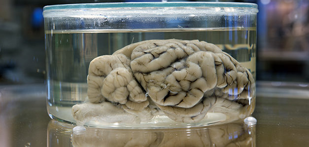 Kids (and Adults) Can Learn About ‘Your Amazing Brain!’ at WonderLab Exhibition
