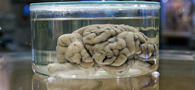 Kids (and Adults) Can Learn About ‘Your Amazing Brain!’ at WonderLab Exhibition